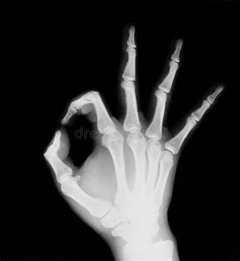 X-ray of human hand (OK!) stock photo. Image of examine - 15761862