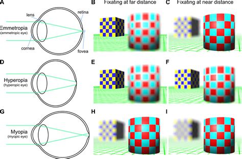 Frontiers Inclusivity In Stereoscopic Xr Human Vision First