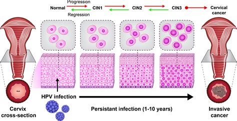 Frontiers An Update On Human Papilloma Virus Vaccines History Types