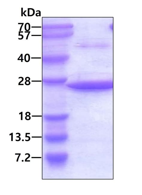 Recombinant Human Uroplakin III protein ab115705 アブカム