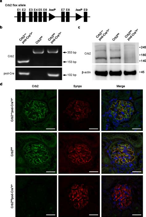 Podocyte Specific Crb Knockout Mice Develop Focal Segmental