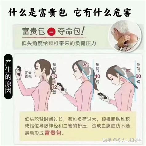 富贵包是什么？ 知乎