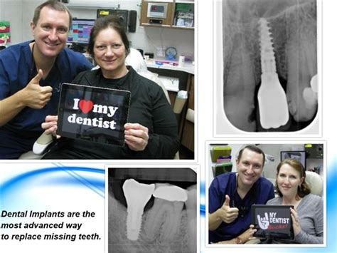 Dental Implants In Pasadena Texas Dr Michael Nugent Dds