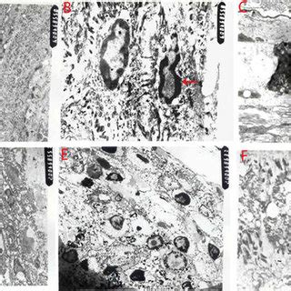 TEM analysis of hair follicles. a A representative anagen hair follicle ...