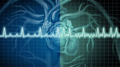 Fibrilação Atrial O Que é Causas Tratamento Risco De Avc