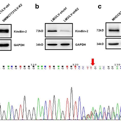 Knockdown Of Kindlin 2 Inhibits Axin2 Expression In Hcc Cells A The