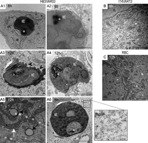 Brain Microvascular Endothelial Cells Internalize P Falciparum Ies Download Scientific