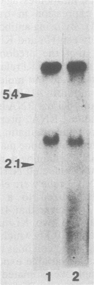 Northern Blot Analysis With Ltr Specific Probe Cellular Rnas Were