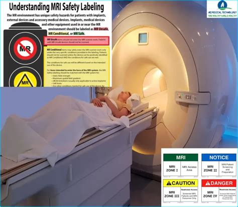 Watchman Device Mri Safety Archives