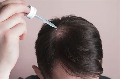 Cuál Es El Ciclo De Vida Del Cabello Y Cómo Identificar Una Caída Excesiva Guía Para Una Melena