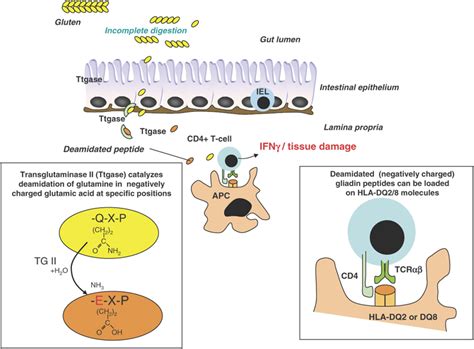 A Keystone Mechanism In Celiac Disease Cd Pathogenesis The Lamina