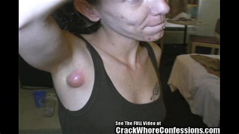 Watch Meth Porn Videos On Free Porn PornTube