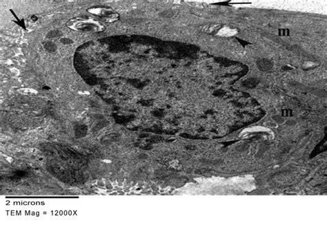 Transmission Electron Micrograph Of A Control Rat