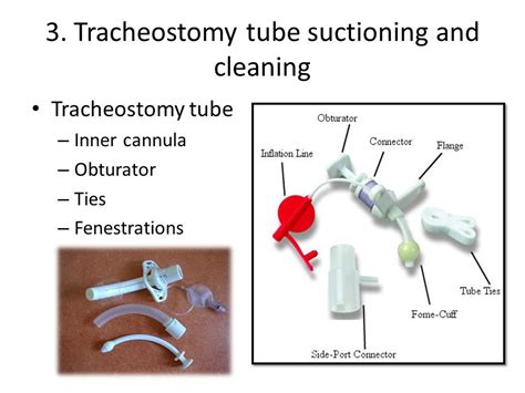 Tracheostomy Tube Suctioning