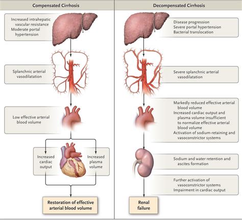 Síndrome Hepatorrenal