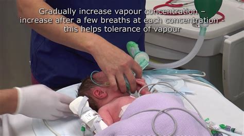 Paediatric Anaesthetics Chapter Inhalational Induction Neonate