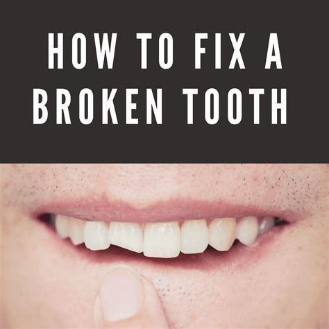 How to Fix a Broken Tooth - Channo DDS