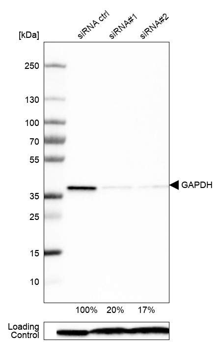 Mouse Monoclonal Anti Gapdh Antibody Buy For Research Highly