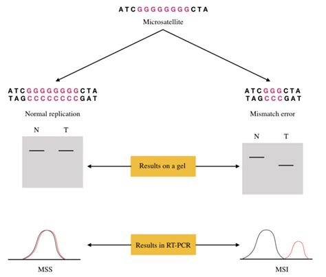 Role Of Microsatellite Instability Msi In Cancer Msi H Msi I And