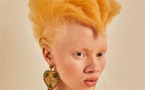 Thando Hopa Le Mannequin Albinos Qui Sublime Le Magazine Vogue Africa Top Success