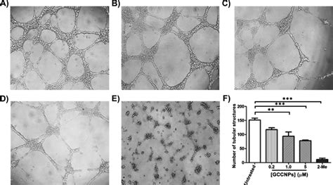 In Vitro Anti Angiogenic Activity Of GCCNPs AF Representative