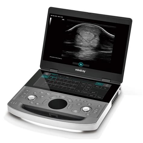 Mindray Vetus EQ Veterinary Ultrasound Machine Best Price UDS