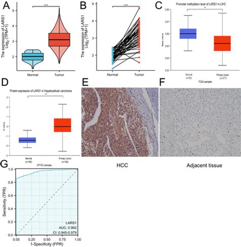 Full Article Lars Is A Prognostic Biomarker And Exhibits A