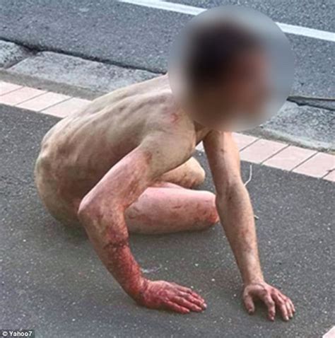 Naked Melbourne Man Found Covered In Blood Pepper Sprayed After