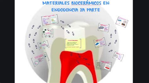 MATERIALES BIOCERÁMICOS EN ENDODONCIA 2A PARTE by Rosalba Martínez