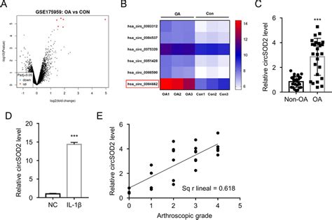 Circsod2 Is Overexpressed In The Oa Clinical Samples And Cell Model A