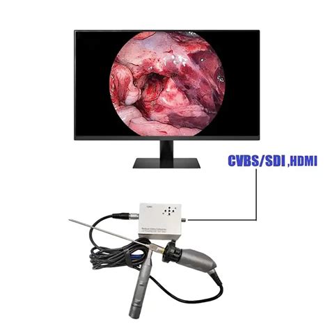 ICEN Full Hd Portable Medical Endoscope Camera Unit Ent Endoscope