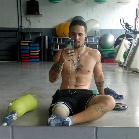 Gay Amputee Fetichism And Others