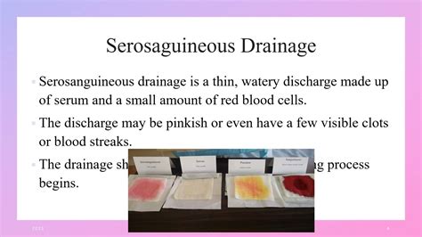 Serous Discharge