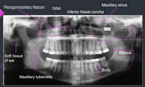 Radiology Review PANORAMIC RADIOLOGY Flashcards Quizlet