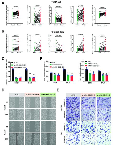 Mir Hg Was Highly Expressed In Hnscc Tissues And Promoted Cell