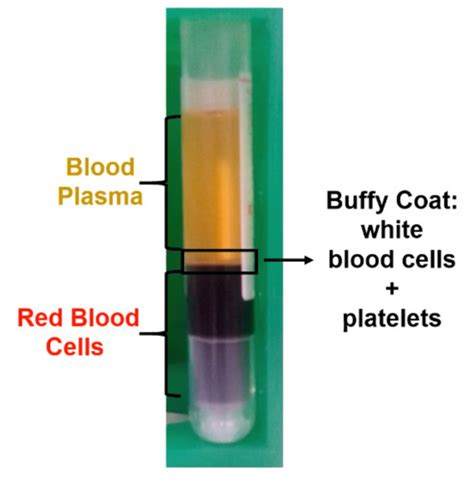 Fundamentals Of Blood And Red Blood Cells Flashcards Quizlet