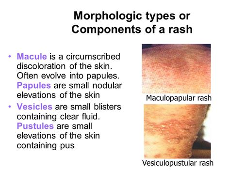 Case 5 “rash Judgment” Ppt Video Online Download