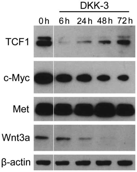 Exogenous DKK3 REIC inhibits Wnt βcatenin signaling and cell