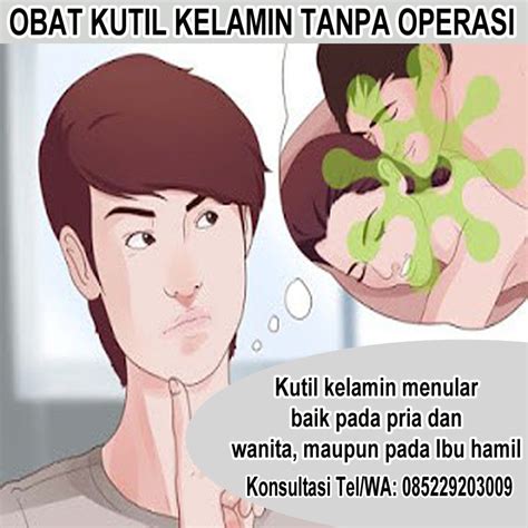 OBAT KUTIL KELAMIN SALEP IMIQUIMOD DI APOTIK TERBUKTI 3 OLES RONTOK 1