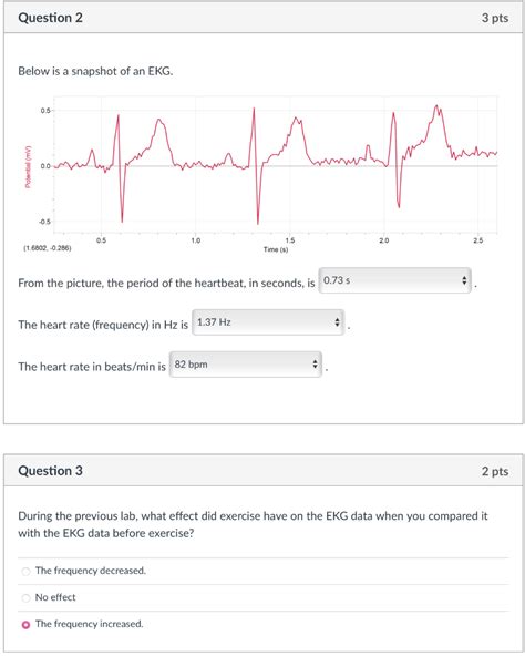 Solved Below Is A Snapshot Of An Ekg From The Picture The Chegg