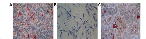 Osteogenic Chondrogenic And Adipogenic Differentiation Of Bmscs At