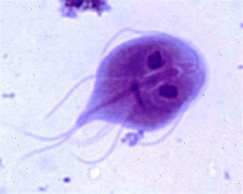 Giardia lamblia - Central Contra Costa Sanitary District