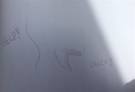 HELP! Muscles hurt after 3 months of mewing (red areas in pic below). I