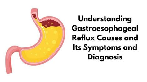 Understanding of the Causes, Symptoms, and Diagnosis of Gastroes, Agra