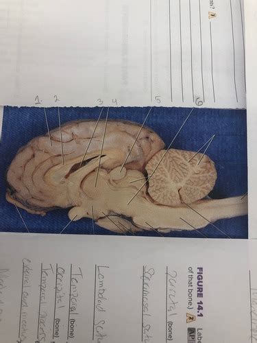 Sheep Brain Flashcards Quizlet