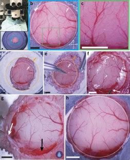 Removable Cranial Windows For Long Term Imaging In Awake Mice Nature