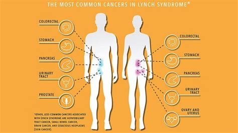 Lynch Syndrome And Cancer Risk