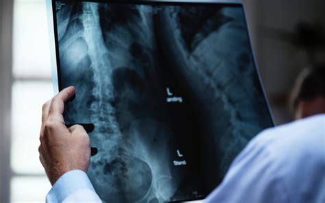 Symptoms of Asbestosis - Recognising the Signs | About the House