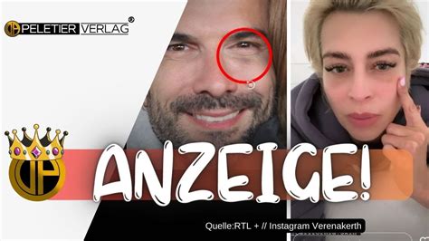 Verena Kerth EXPLODIERT nach PRÜGEL ANSCHULDIGUNGEN gegen Marc Terenzi