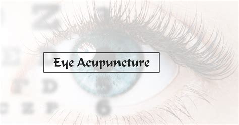 Acupuncture Eye Akupunktur Di Surabaya